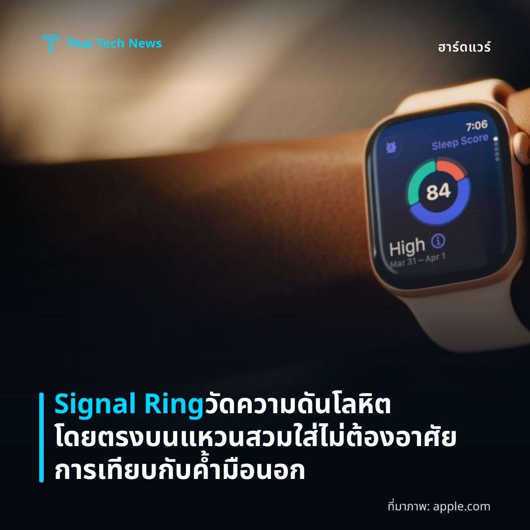 Signal Ring วัดความดันโลหิตโดยตรงบนแหวนสวมใส่ ไม่ต้องอาศัยการเทียบกับค้ำมือนอก