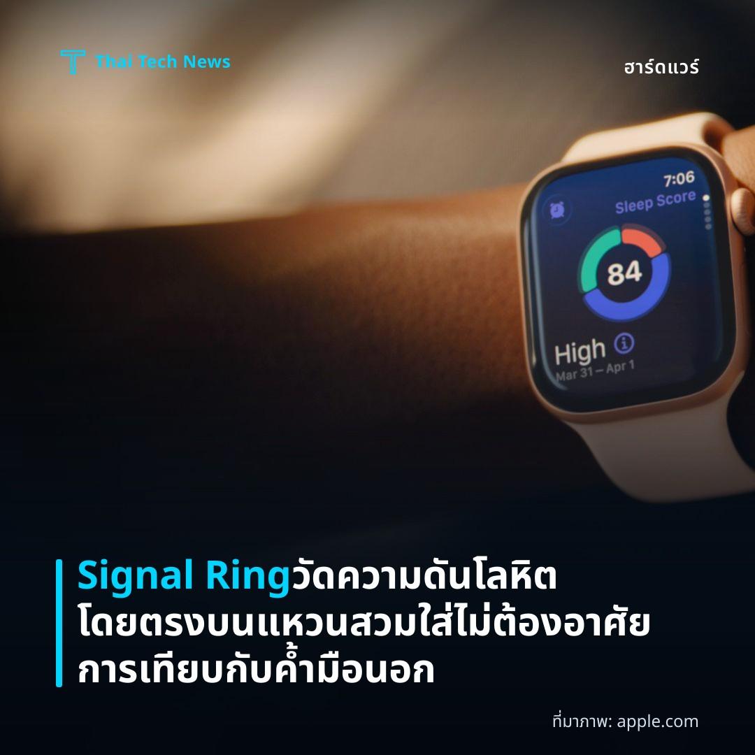 Signal Ring วัดความดันโลหิตโดยตรงบนแหวนสวมใส่ ไม่ต้องอาศัยการเทียบกับค้ำมือนอก